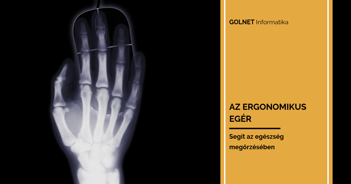 Az ergonomikus egér segít az egészség megőrzésében